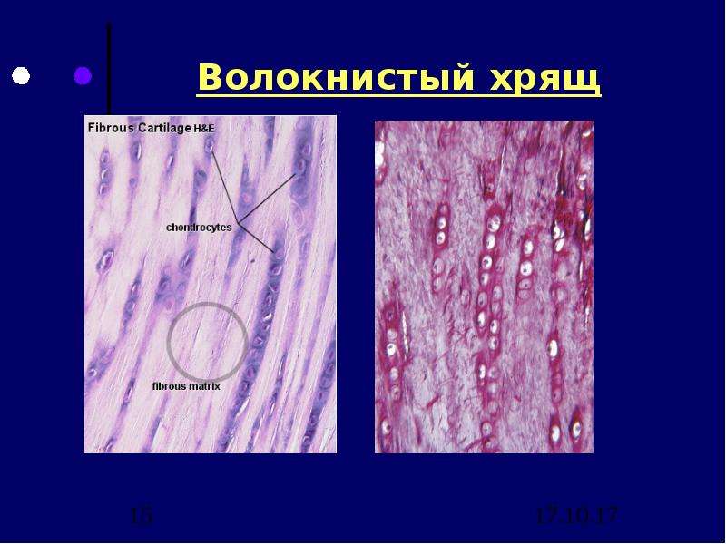 Волокнистый хрящ гистология рисунок