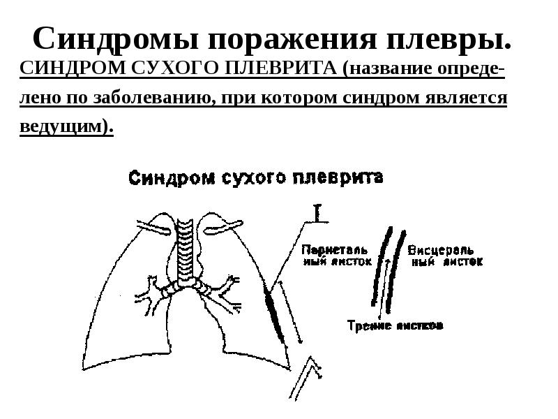 Отделы плевры