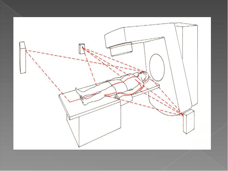 Чем рисуют разметку для лучевой терапии
