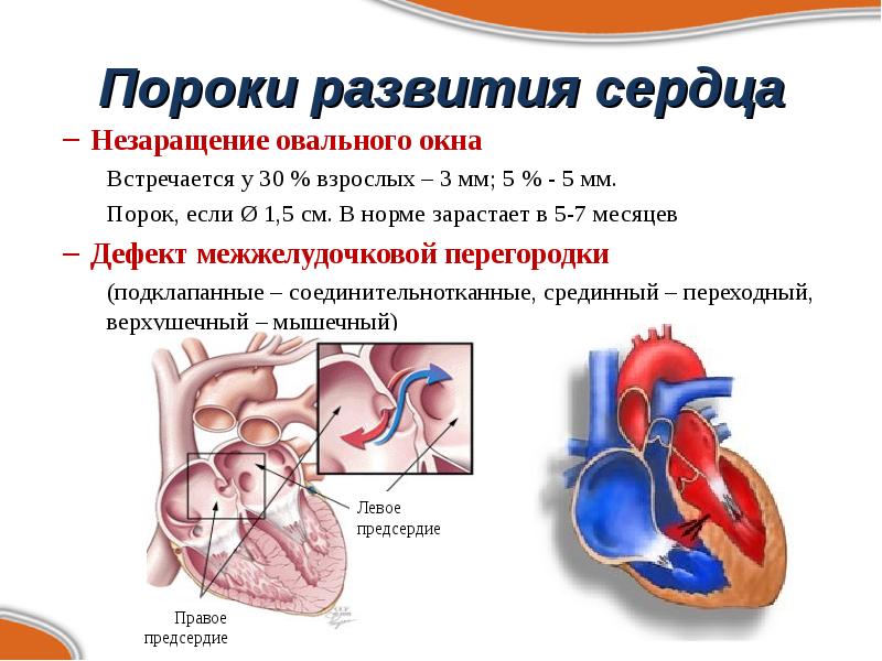 Пороки сердца презентация терапия