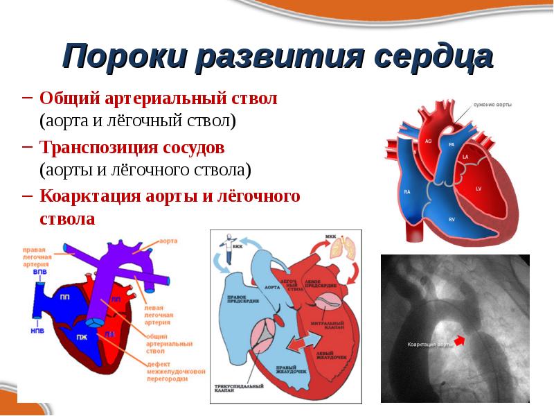 Формирование сердца