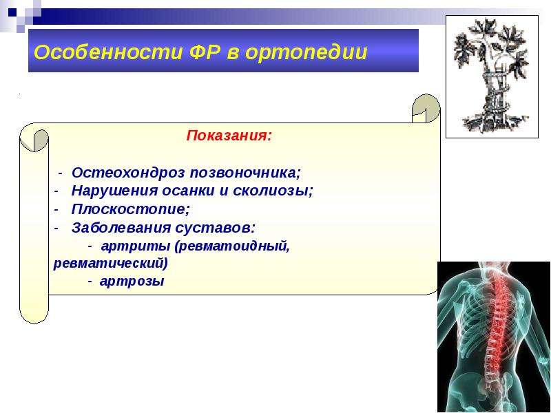 Сколиотическая болезнь травматология презентация