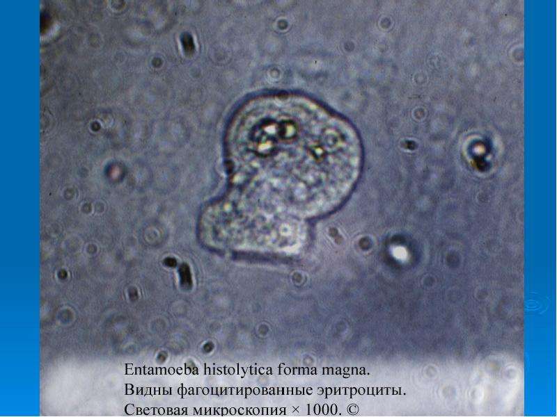 Entamoeba coli в кале. Entamoeba histolytica циста. Цисты Entamoeba. Entamoeba histolytica в микроскоп.