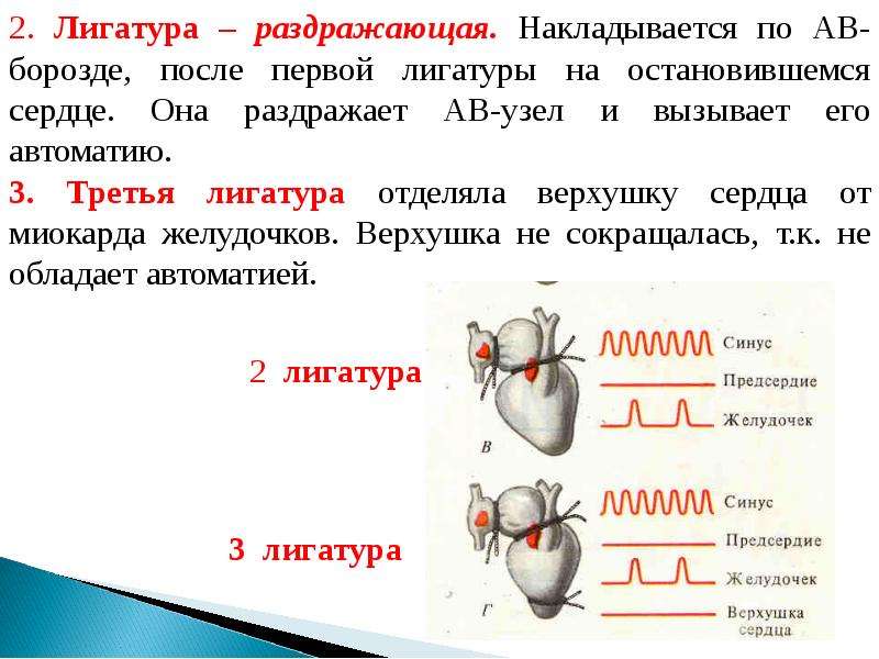 Схема наложения лигатур