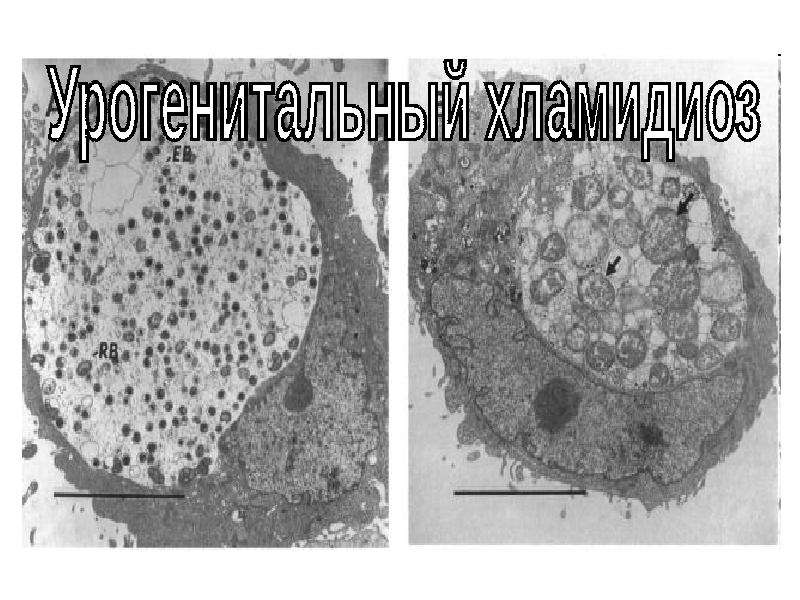 Презентация на тему хламидиоз