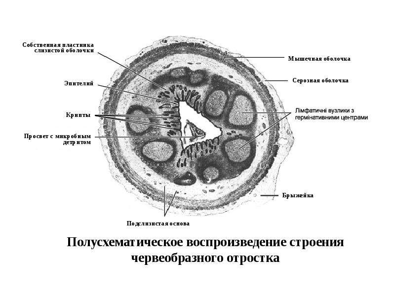 Стенка аппендикса