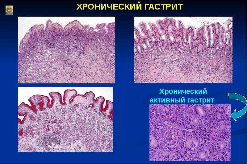 Изменения слизистой оболочки полости рта при заболеваниях жкт презентация