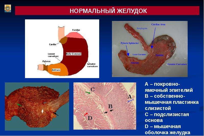 Картинки желудочно кишечного тракта у человека