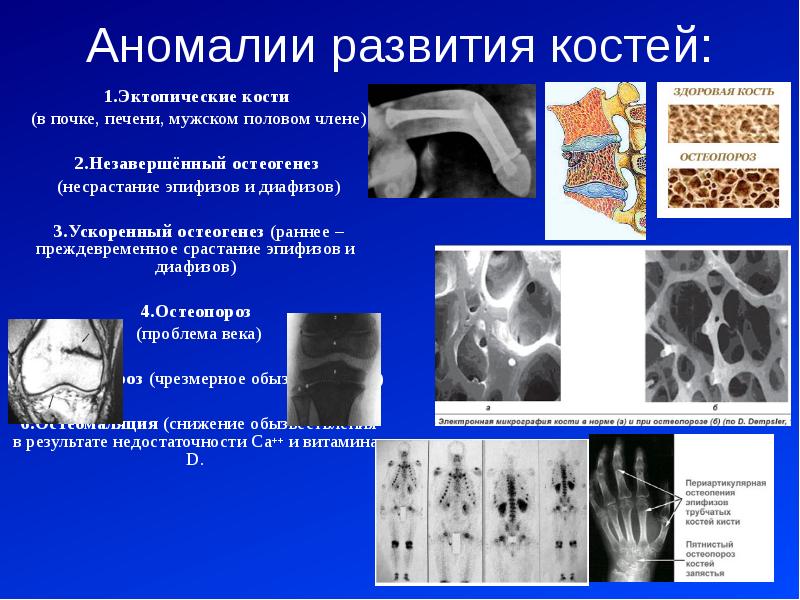 Репаративный остеогенез презентация