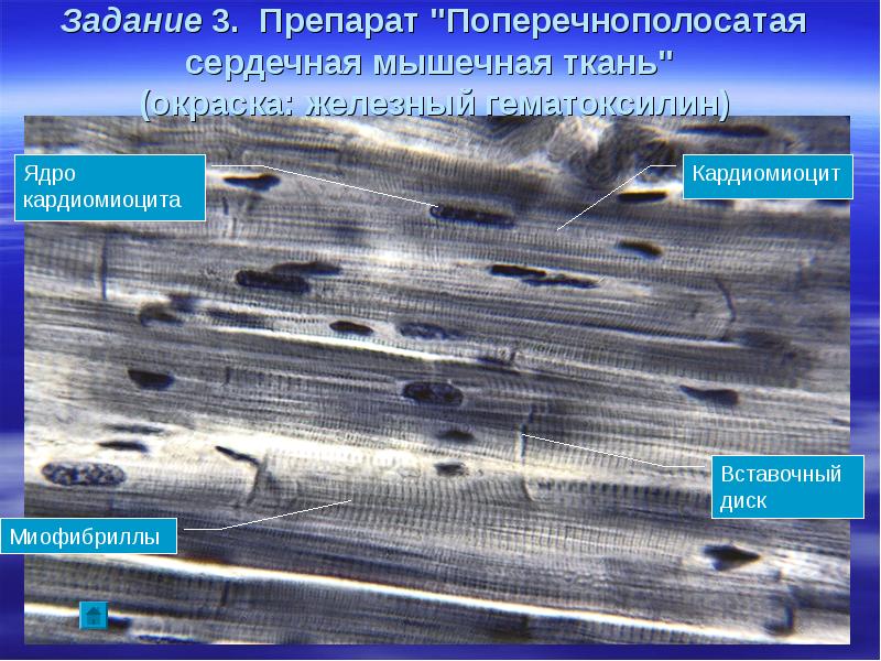 Поперечно полосатая сердечная мышечная ткань гистология рисунок