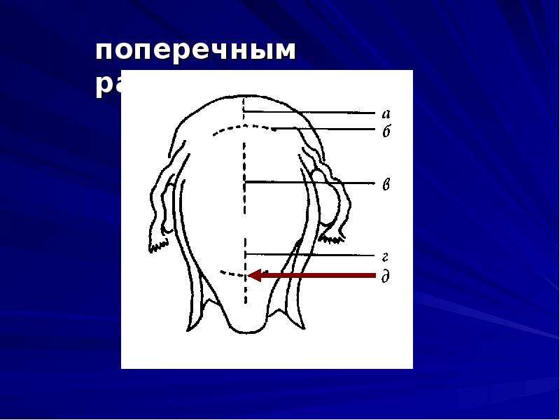 Для клинической картины перитонита после операции кесарева сечения на фоне хориоамнионита характерно