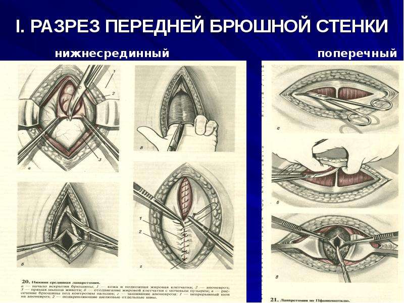 Кесарево сечение кошки картинки