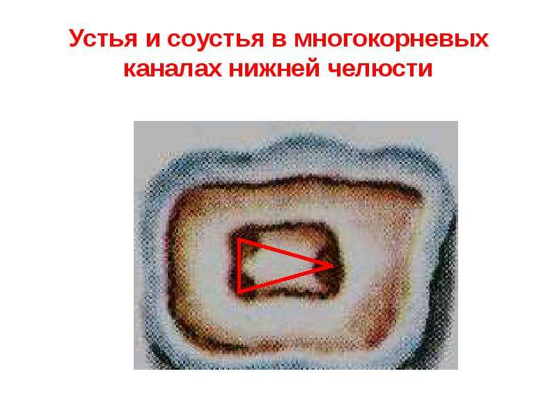 Строение пульпы презентация