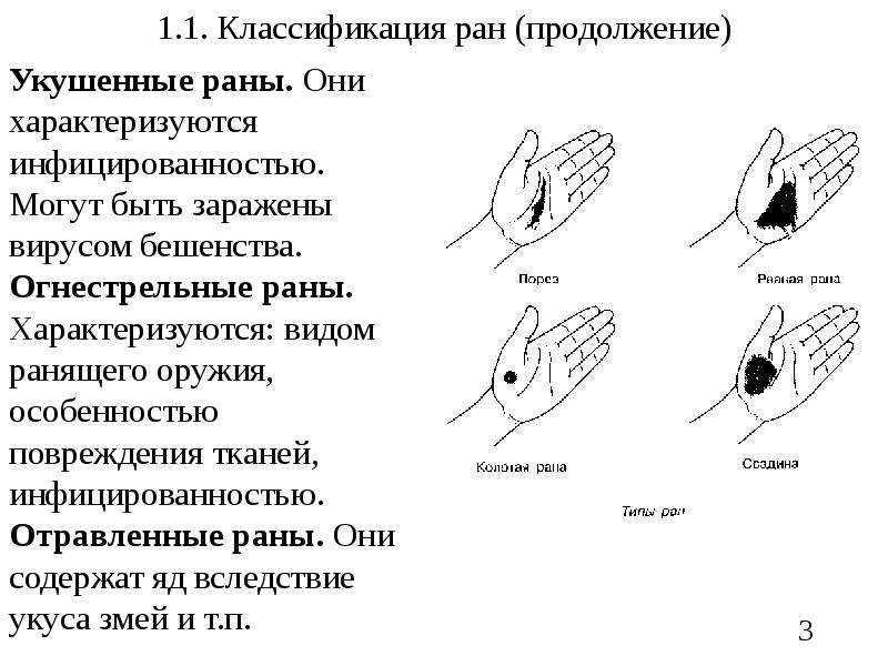 Виды ран. Укушенные раны симптомы. Укушенные раны характеристика. Характерный признак укушенной раны:. Укушенная рана особенности.