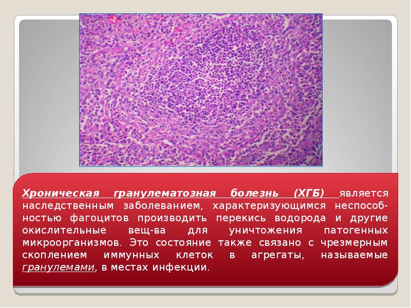 Патология фагоцитоза, слайд 20