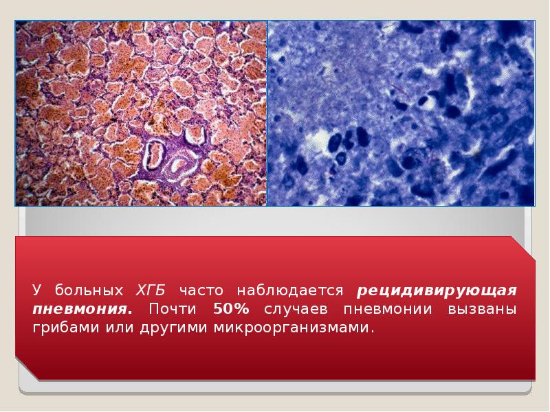 Патология фагоцитоза, слайд 26