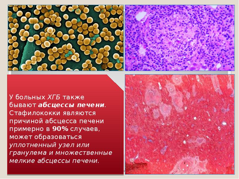 Открытие фагоцитоза презентация