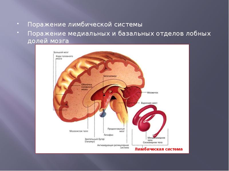 Амнезия картинки для презентации