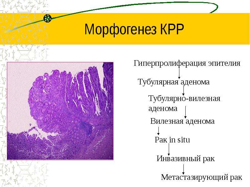 Тубулярная грудь картинки