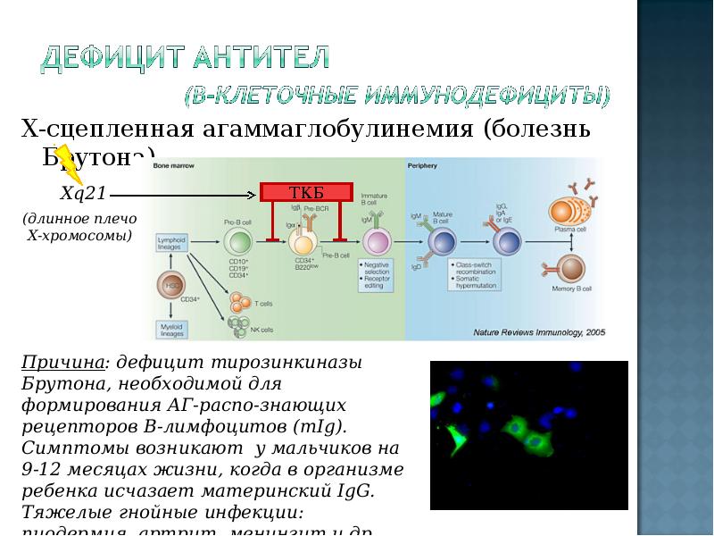 Болезнь брутона