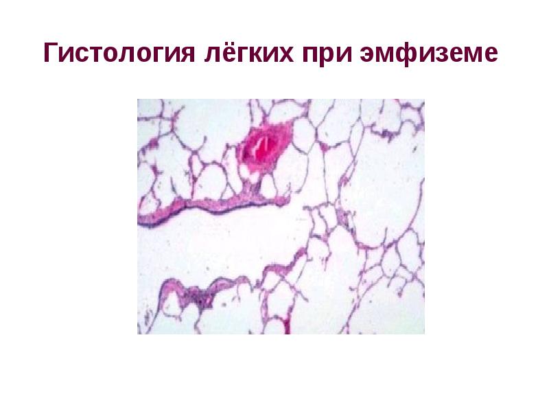 Легкое гистология