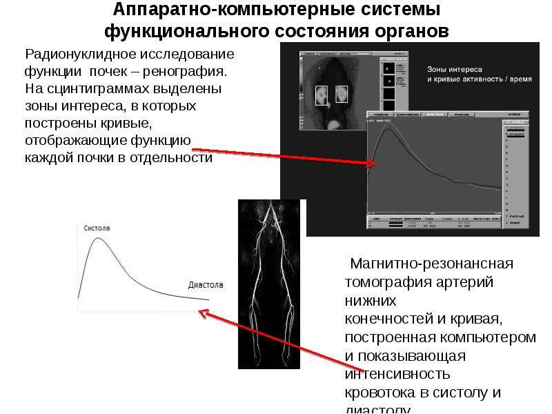 Радионуклидное исследование почек. Аппаратно компьютерные медицинские системы презентация. Что такое аппаратно компьютерные мед системы. Функциональное состояние почек.