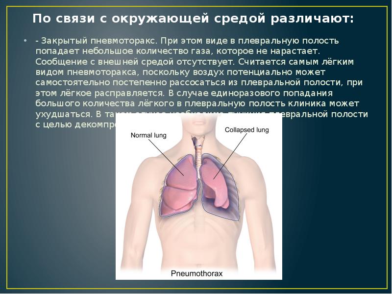 Полость попасть. Травматический пневмоторакс. Закрытый травматический пневмоторакс. Границы легких при пневмотораксе. Попадание воздуха в плевральную полость.