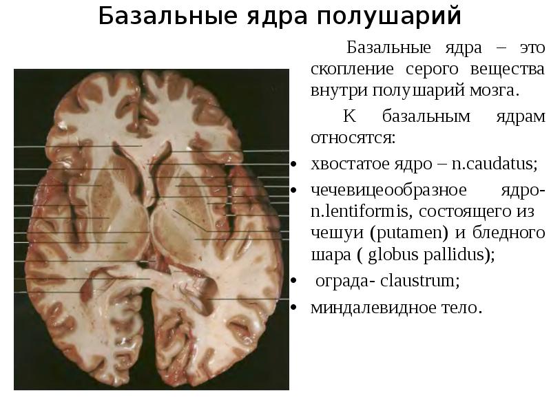 Базальные ядра. Базальные ядра чечевицеобразное ядро. Чечевицеобразное ядро мозга. Серое вещество ядер больших полушарий. Базальные ядра внутренняя капсула.