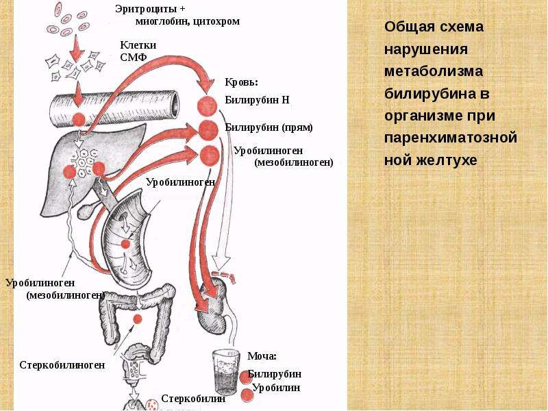 Паренхиматозная желтуха схема