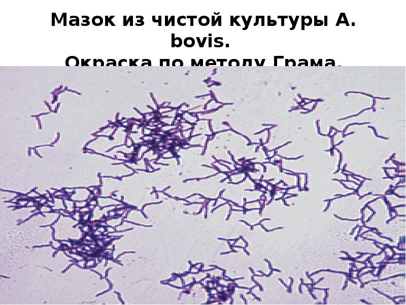 Лептотрикс лечение. Мазок актиномицеты риккетсии хламидии. Микоплазмы спирохеты актиномицеты. Микроскопия актиномицетов.