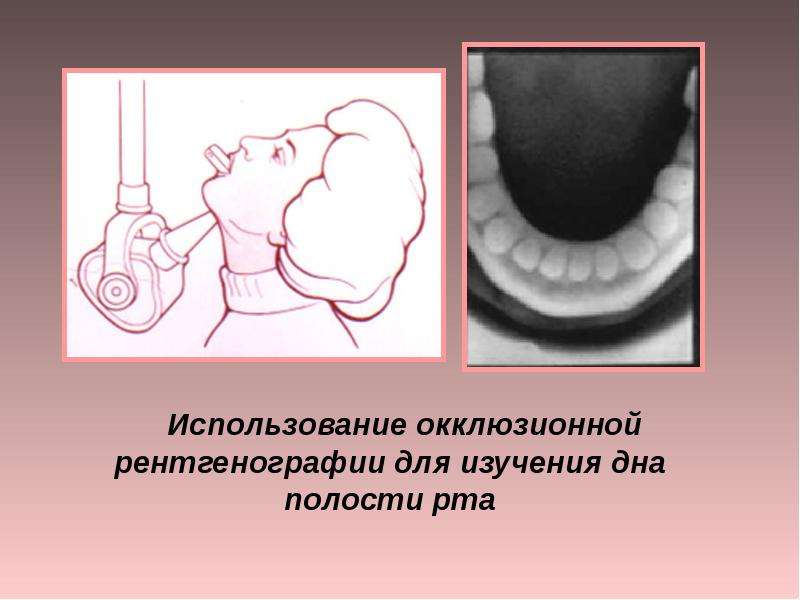 Рентгенодиагностика в стоматологии презентация