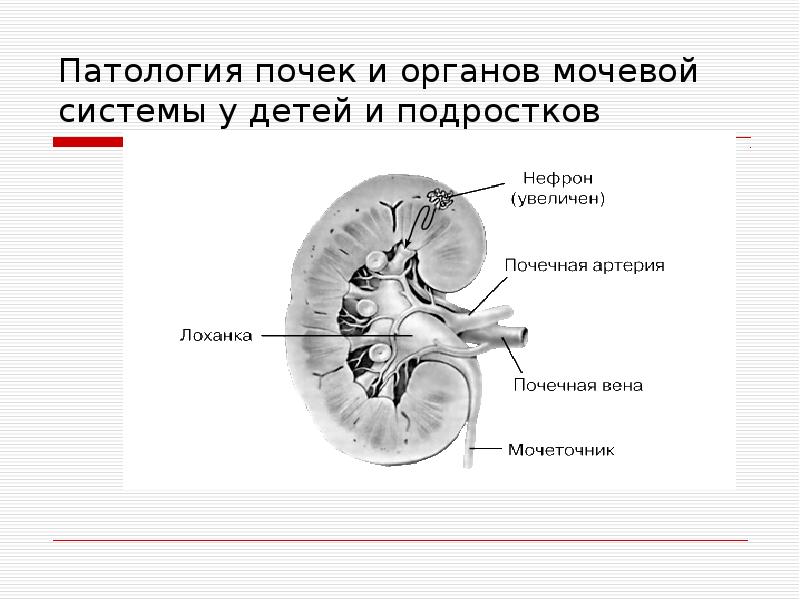 Патология почек презентация