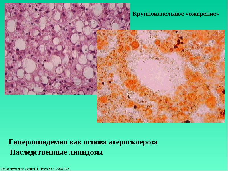 Презентация на тему дистрофия