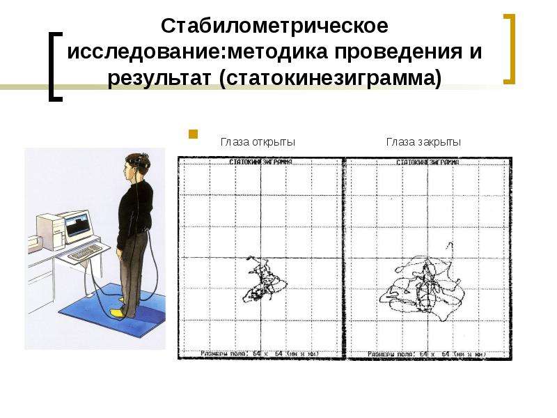 Методы исследования вестибулярного аппарата презентация