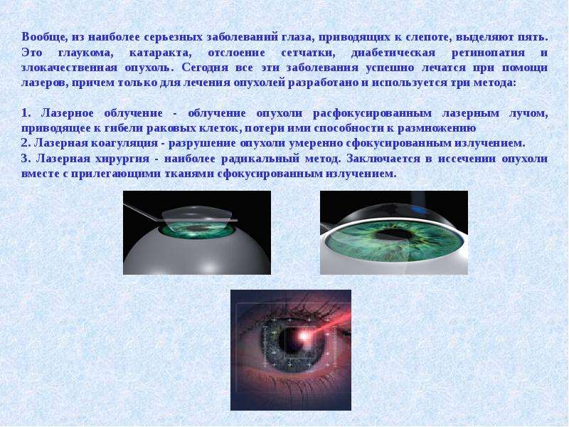 Проект по физике про лазеры