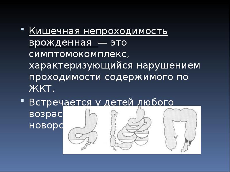 Врожденная кишечная. Врожденная кишечная непроходимость клинические рекомендации. Врождённая уишечная непроходимость. Врожденная кишечная непроходимость презентация. Высокая непроходимость кишечника.