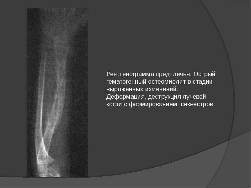 Методы обследования в кардиологии презентация