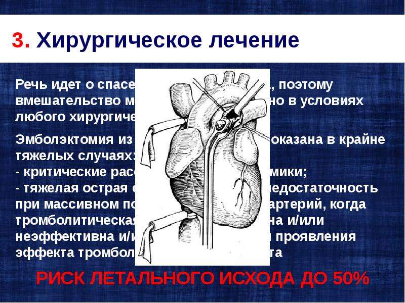 История легочной хирургии презентация