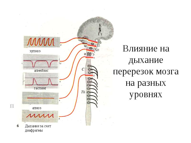 Апнейстическое дыхание рисунок