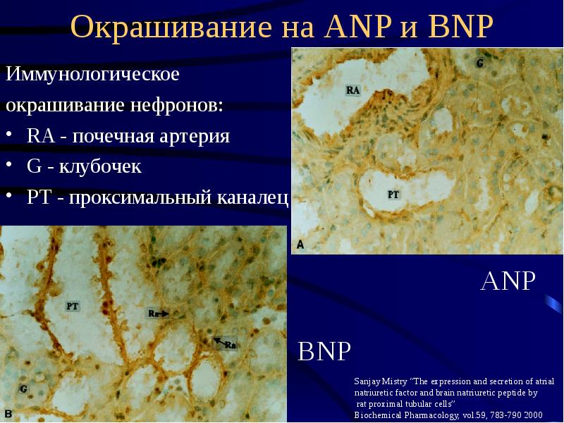 Окрашивание на ANP и BNP Иммунологическое окрашивание нефронов: RA - почечная артерия G - клубочек Р