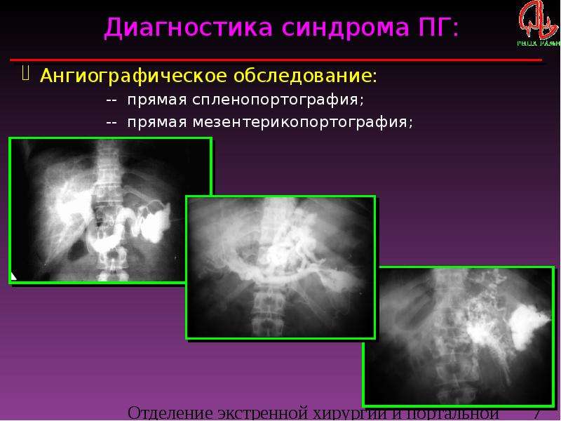 Портальная гипертензия хирургия презентация