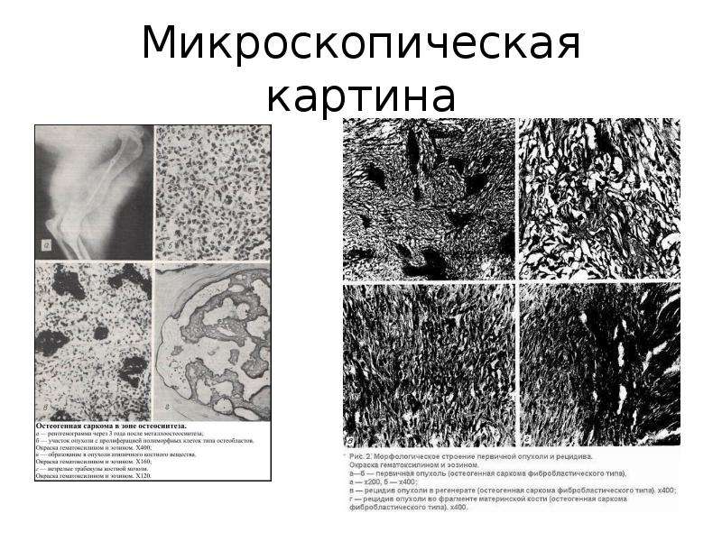 Микроскопическая картина. Диатомит микроскопическая картина. Диатомит микроскопическая картина ботаника. Микроскопическая картина v что это. Макро и микроскопическая картина кости.