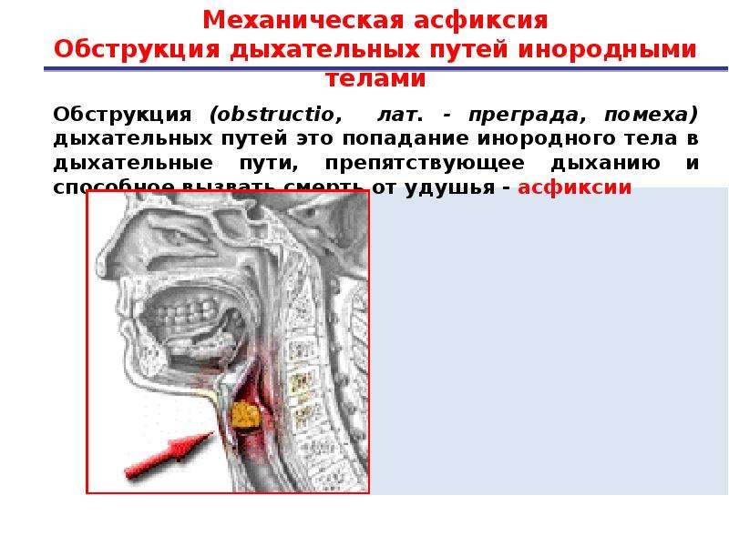 Презентация на тему болезни верхних дыхательных путей