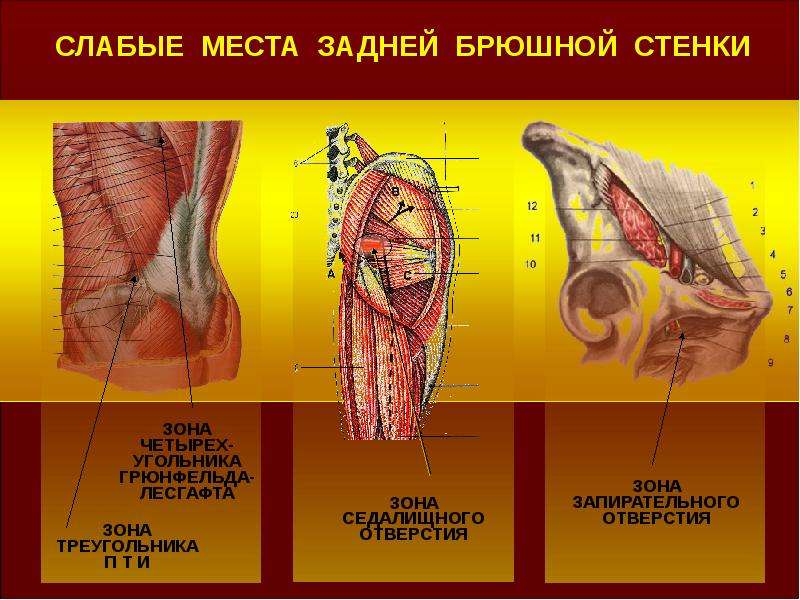 Слабые стенки. Задняя брюшная стенка анатомия. Задняя стенка передней брюшной стенки. Слабые места брюшной стенки. Слабые места задней брюшной стенки.