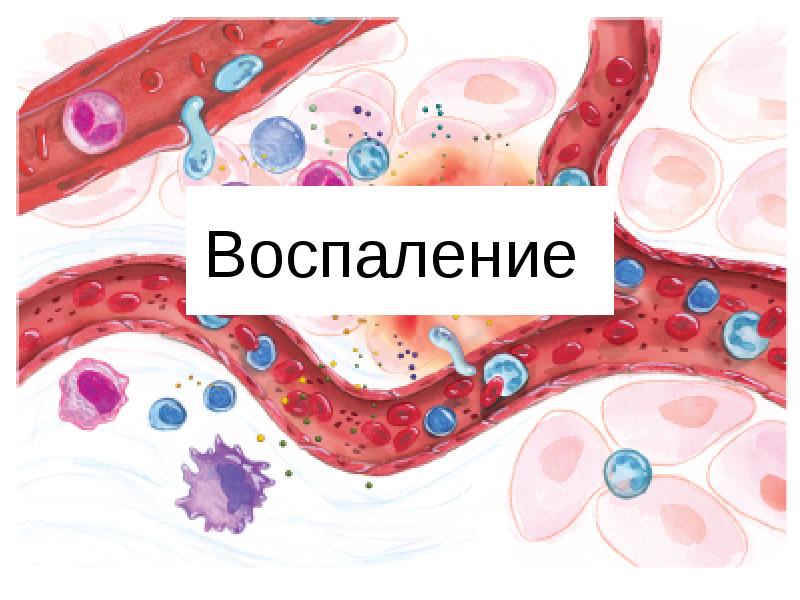 Воспаление картинки для презентации