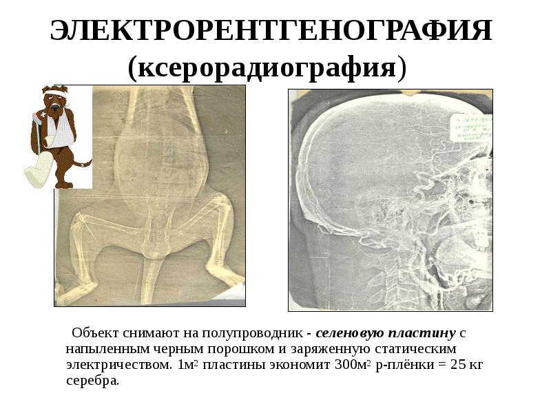 При электрорентгенографии изображение получают