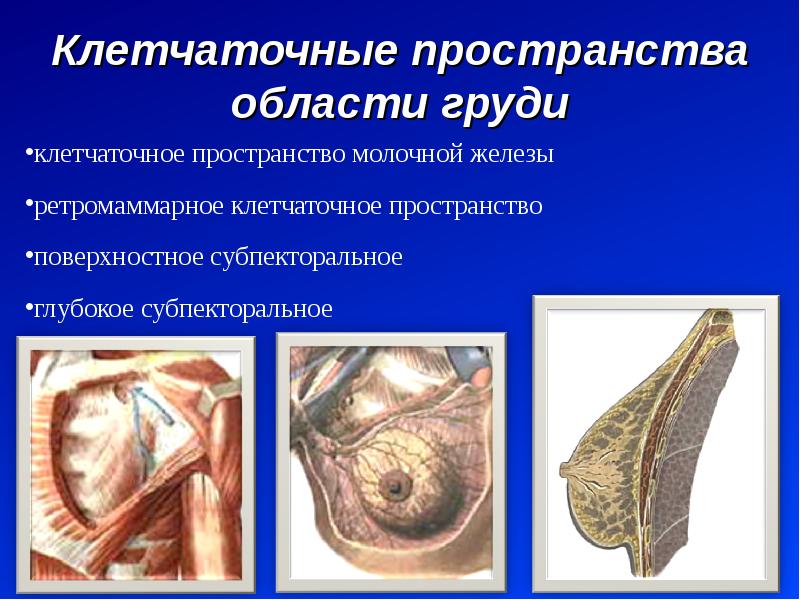 Передняя грудная стенка клетчаточные пространства