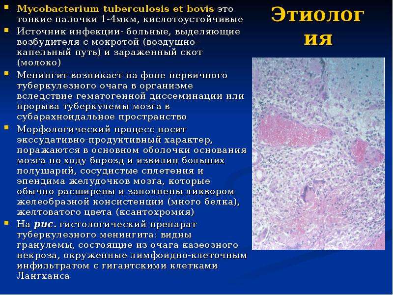 Воздушно капельный менингит. Кислотоустойчивые микобактерии. Микобактерия Бовис.