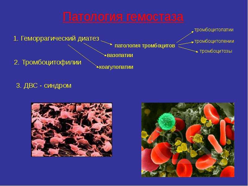 Тромбоцитоз. Тромбоцитопении и тромбоцитопатии. Тромбоцитопения и тромбоцитопатия. Тромбоцитопении тромбоцитопатии коагулопатии. Тромбоциты при тромбоцитопатии.