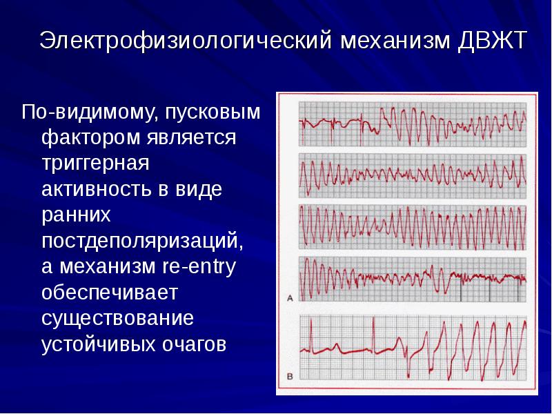 Нарушение ритма презентация